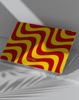 Sauce Happens Macbook Case