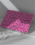 Valentine Macbook Case