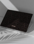 Black Salt Macbook Case