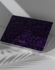 Purple Static Macbook Case