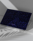 Blue Static Macbook Case