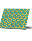 Cyanana  Macbook Case