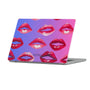 Pucker Up! Macbook Case