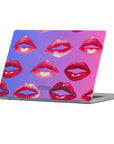 Pucker Up! Macbook Case