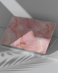 Kate Macbook Case