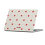 Starluck Macbook Case