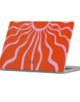 Summer Shine Macbook Case