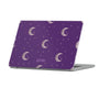 Moonfall Macbook Case