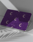 Moonfall Macbook Case