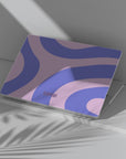 Skate Macbook Case