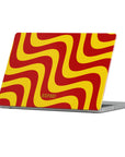 Sauce Happens Macbook Case