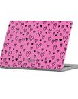 Valentine Macbook Case