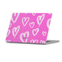 Smitten Macbook Case