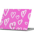 Smitten Macbook Case