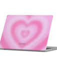 Catch a Vibe Macbook Case