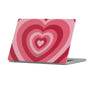 My Crush Macbook Case