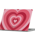 My Crush Macbook Case