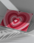 My Crush Macbook Case