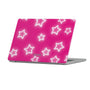 Starstruck Macbook Case