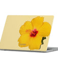 Hibiscus Macbook Case