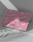 Cherry Camo Macbook Case