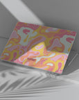 Faze Macbook Case