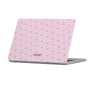 Glee Macbook Case