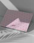 Glee Macbook Case