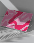 Vibe Check Macbook Case