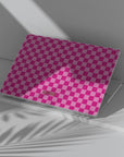 Check Me Out Macbook Case